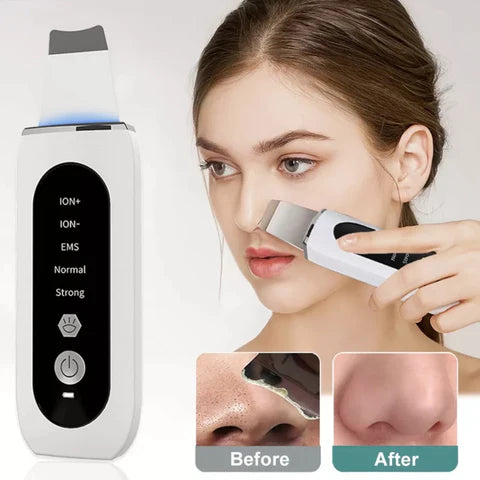 PureSonic™ - Ultrasonic Skin Scrubber - Shoppirillo